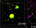 File:A-Novel-Technique-for-the-In-Vivo-Imaging-of-Autoimmune-Diabetes-Development-in-the-Pancreas-by-Two-pone.0015732.s005.ogv